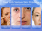 Digital Skin Moisture & Oil Analyzer